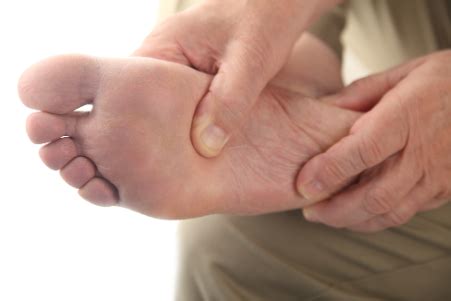 Diabetes Foot Care: A Comprehensive Guide to Prevention and Management