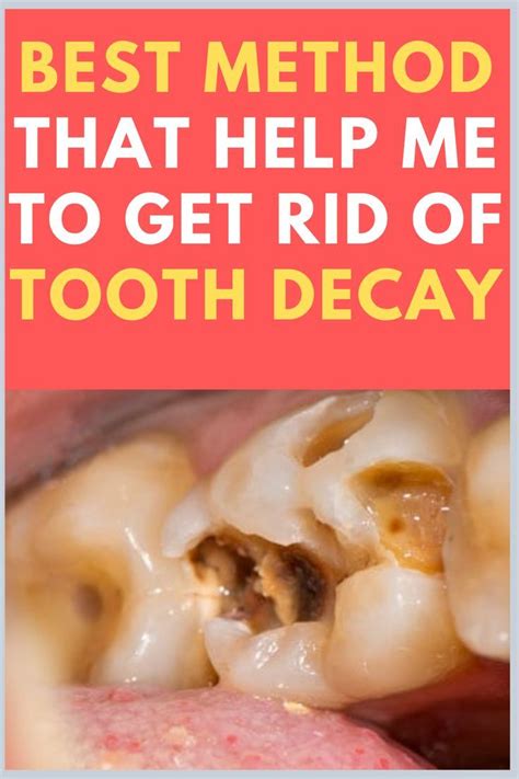 This Simple 20-Second Trick Turns Back Years Of Tooth Decay in 2022 ...