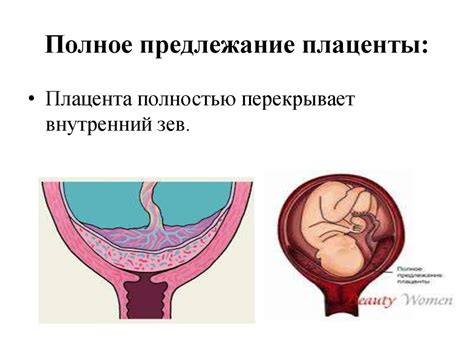 Патология околоплодных вод. Аномалии плаценты. Аномалии пуповины ...