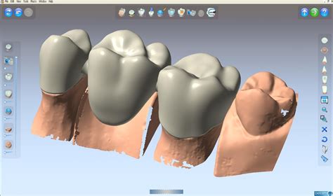 Delcam wins Queen's Award for dental CADCAM - Oral Health Group