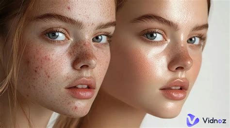 top  blemish remover