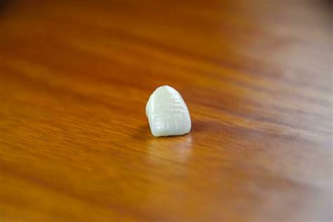 Ceramic Tooth Stock Photos, Images and Backgrounds for Free Download