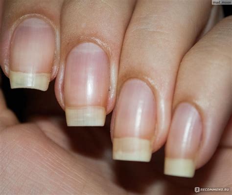 Гель для удаления кутикулы Sally Hansen Instant Cuticle Remover - «Один ...