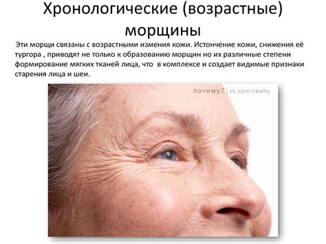 Морщины как признак старения кожи - online presentation