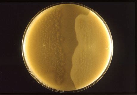 gram positive stock pictures editorial images  stock