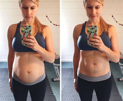 How can I know that I have diastasis? You can detect it yourself by a