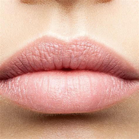 Hard Lump In Lip After Juvederm - Infoupdate.org
