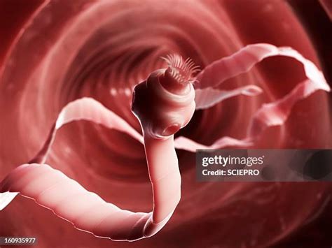Taenia Saginata Photos and Premium High Res Pictures - Getty Images