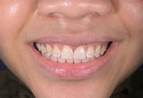 close  gap dr shanaz klinik pergigian fauziah