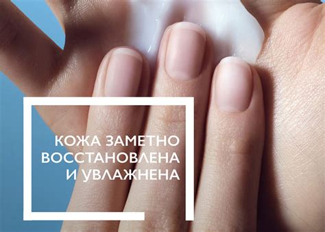 Сухая кожа рук — почему появляется сильная сухость, что делать