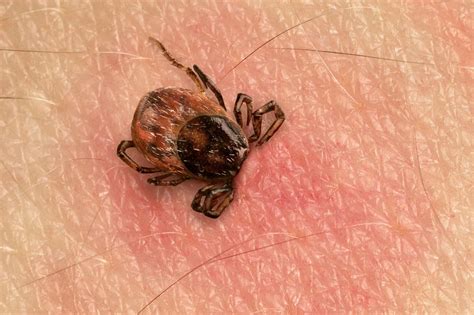 What Does a Tick Bite Look Like?