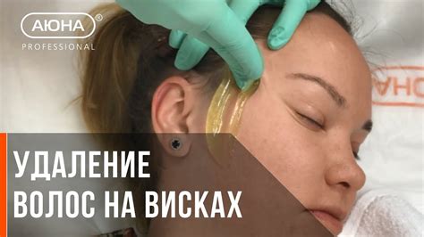Удаление волос на висках - YouTube