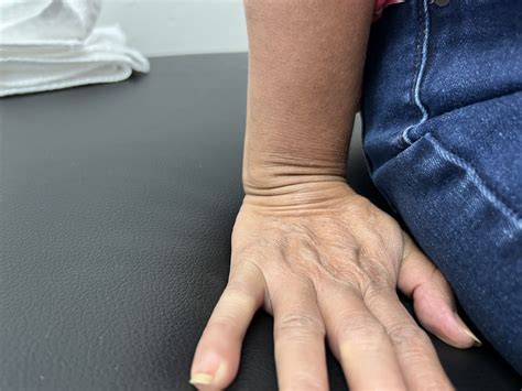 Wrist pain and when to get help - Hands on Therapy