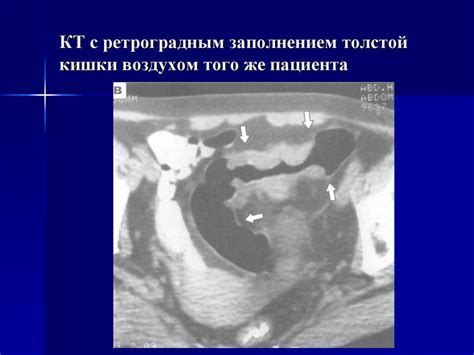 Лучевая диагностика заболеваний органов желудочно-кишечного тракта ...