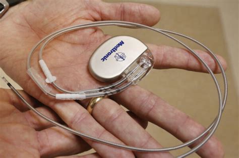 Living With Pacemaker: A Tiny Device That Monitors Your Heart Rhythm ...