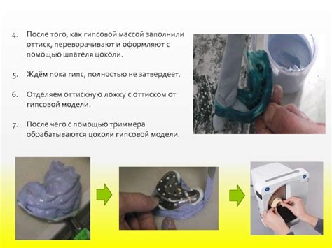 ГИПС презентация, доклад