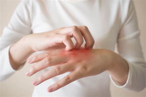 Blister itchy rash on hands. Dyshidrosis: Causes, Symptoms, and