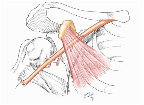 Axillary Artery | Basicmedical Key