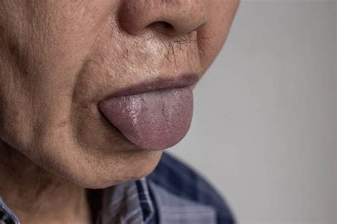 80+ Cyanose Photos, taleaux et images libre de droits - iStock