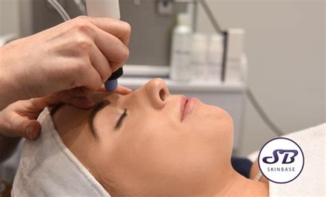 Microdermabrasion treatment? Yes, please!