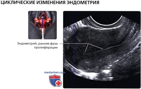 УЗИ анатомия матки в норме