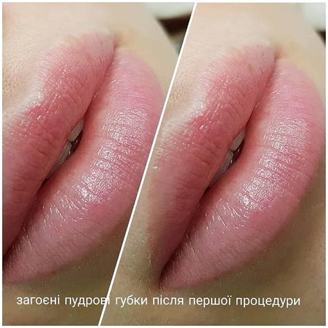 Татуаж Губ, Повік, Очей , Мікроблейдінг Брів