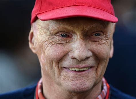 Niki Lauda Before And After