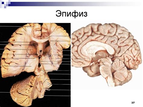 Эндокринные железы - презентация онлайн