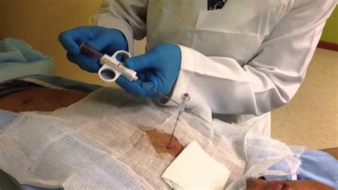 procedure  lung biopsy   recovery  results  health advisor