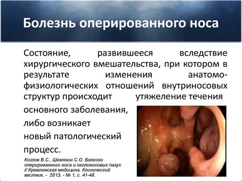 Болезнь оперированного носа - презентация онлайн