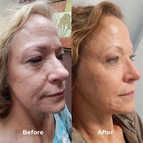 Rosealine Dawnxs: Before & After Results Will SHOCK You! Image 19