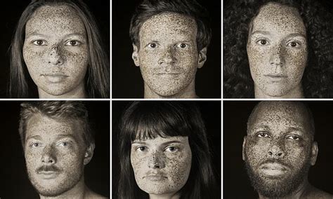 Shocking 'ultraviolet portraits' show the reality of sun damage | Daily ...