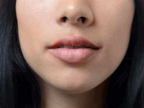 rash  swollen lips lipstutorialorg