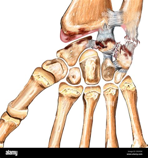 Lateral Ulnar Collateral Ligament