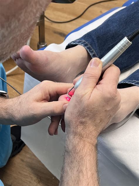 What is fungal nail and how do... - The Foot and Gait Clinic | Facebook