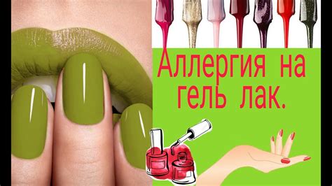 # Аллергия #Гель лак Аллергия на гель-лак ( решение проблемы) - YouTube