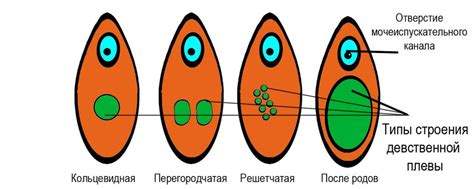 Что такое дефлорация?
