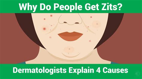 Why Do People Get Zits? Dermatologists Explain 4 Causes