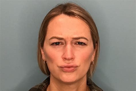 Injectables - Taylor Plastic Surgery