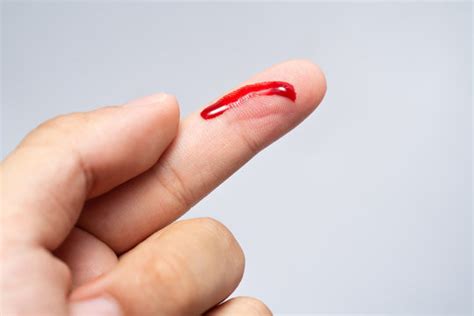 Bleeding Cut Images – Browse 20,974 Stock Photos, Vectors, and Video ...