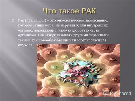 Презентация на тему: "Рак головного мозгаРак головного мозгаЧто такое ...