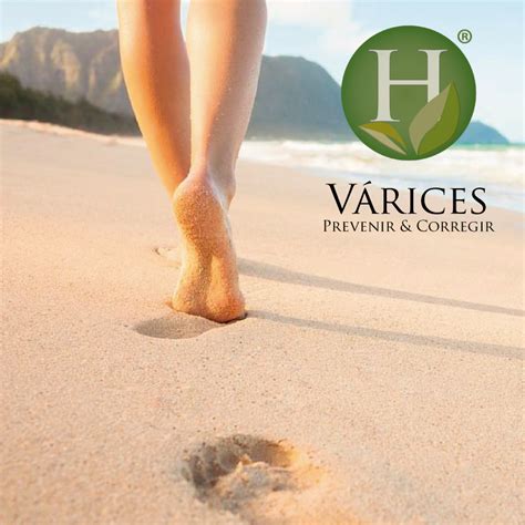 Várices