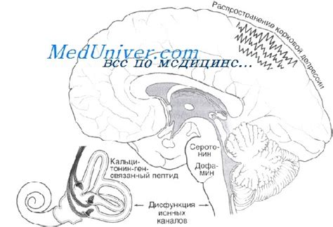Патогенез головокружения при мигрени. Механизмы развития мигренозного ...