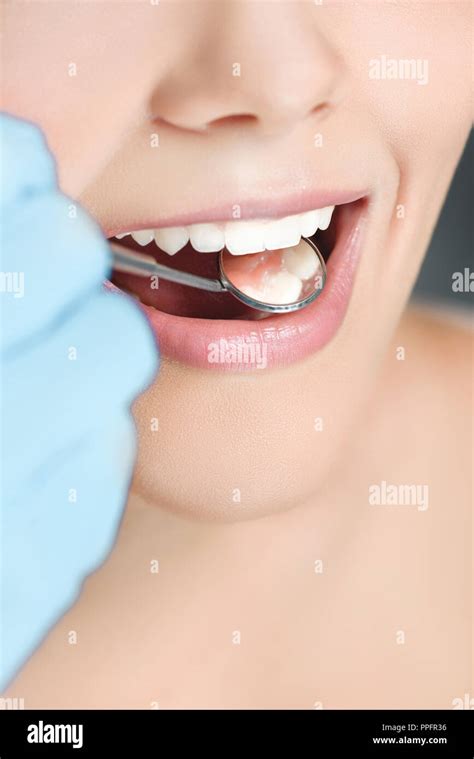 partial view of dentist with dental mirror checking womans teeth Stock ...