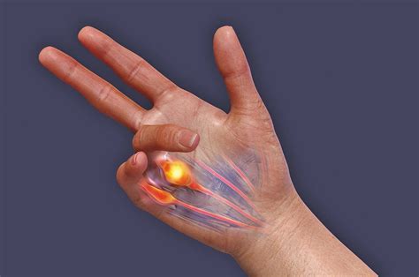 facts  fingers factsnet