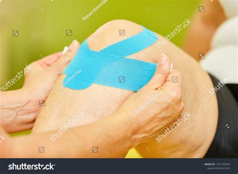 Patient Gets Kinesio Tape Knee Joint Stock Photo 1747120304 | Shutterstock