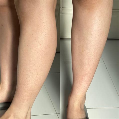 Bumps & ingrown hair! I exfoliate whenever I shower with a brush and