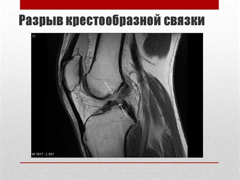 Повреждения коленного сустава - презентация онлайн