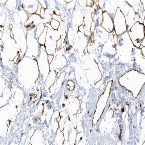 ECM2 - Antibodies - The Human Protein Atlas
