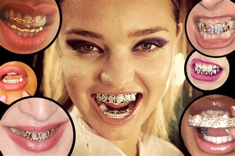 Grillz celebrities mania | Vogue Italia